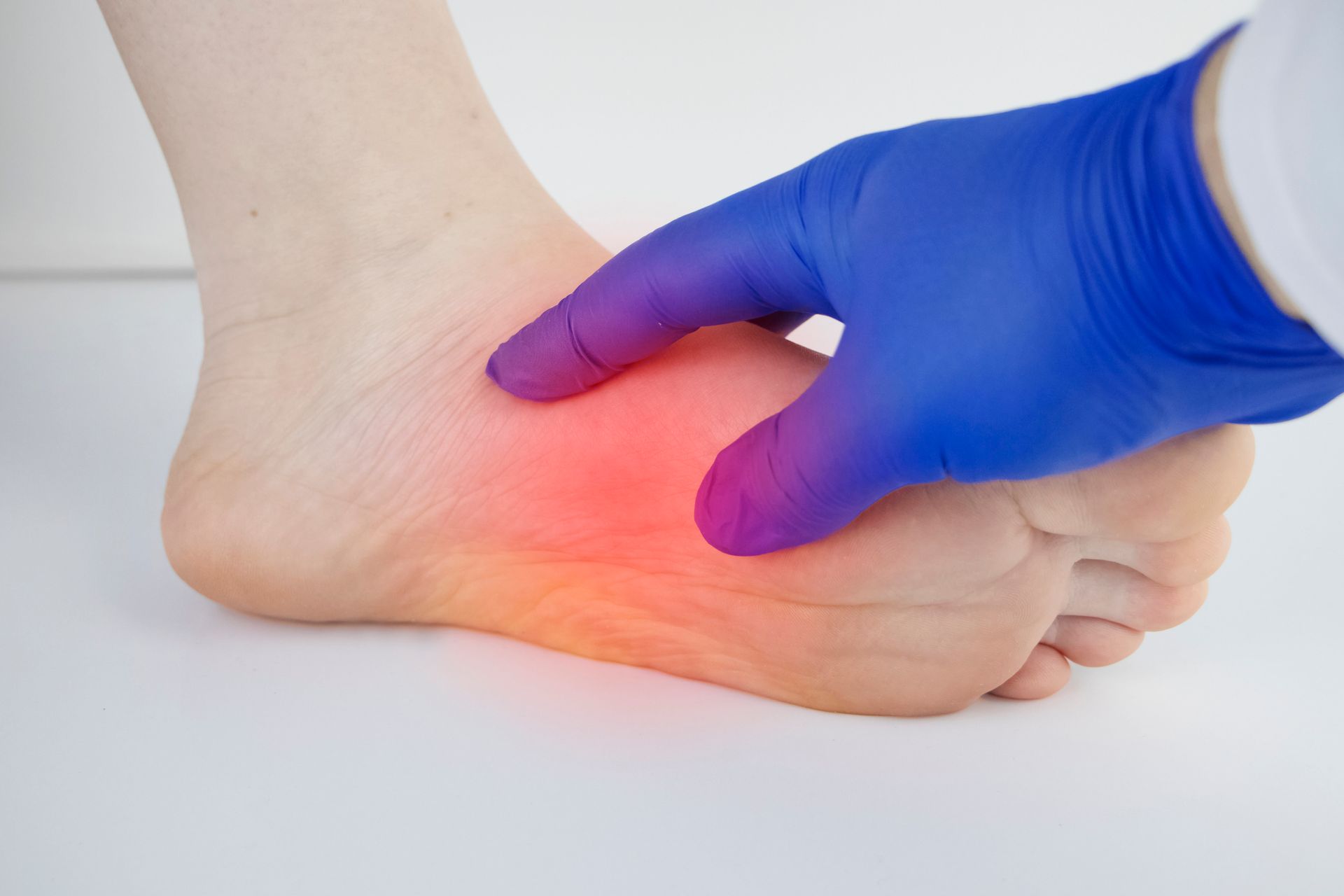 Podiatrist wearing blue gloves examining foot inflammation, providing expert foot care treatment.