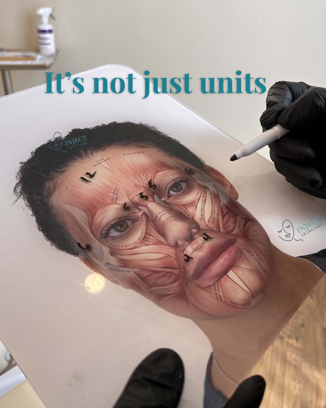 Wrinkle Relaxers in Prescott, AZ: Why It's Not Just About Units