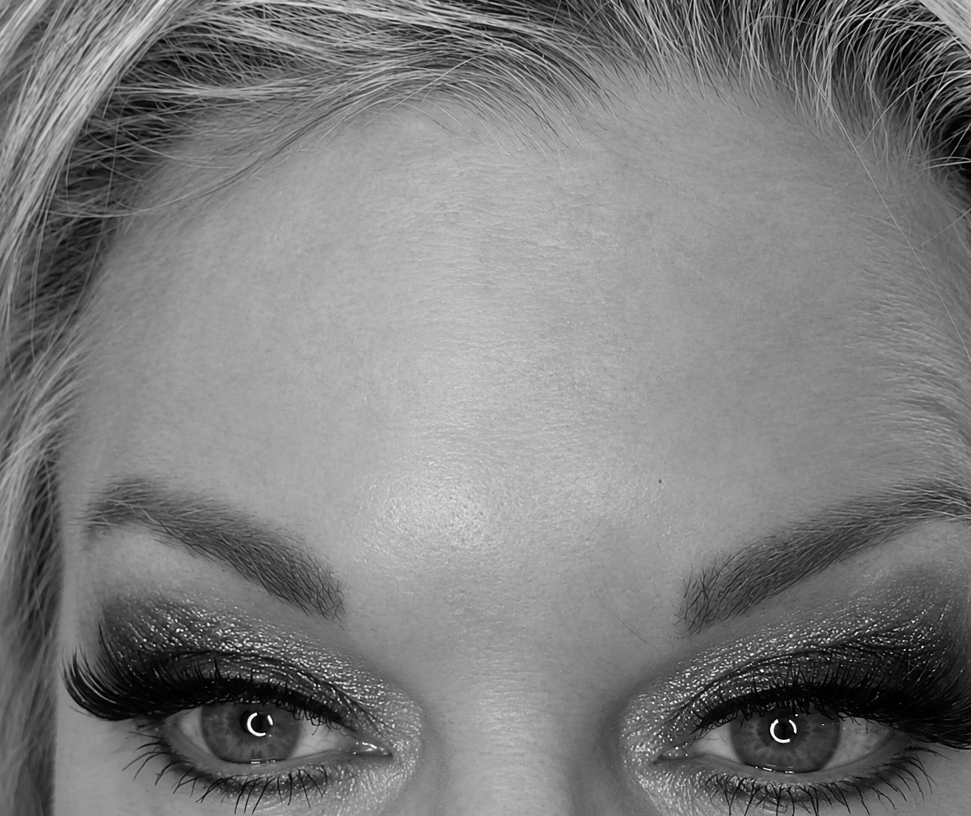 Close-up of after the wrinkle relaxer treatment showing a smooth forehead with no more wrinkles.