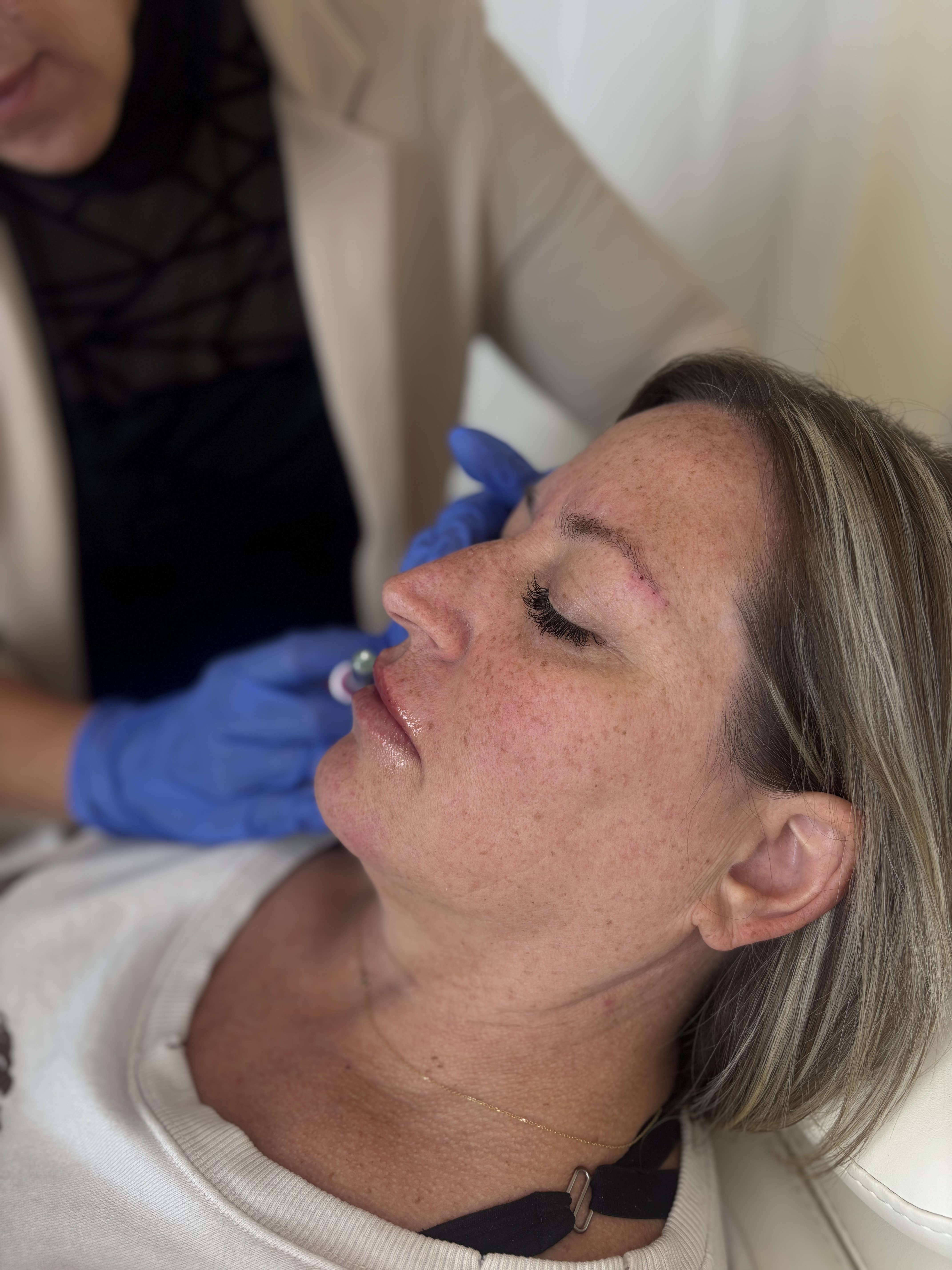 Person receiving a cosmetic facial injection while reclined on a treatment bed