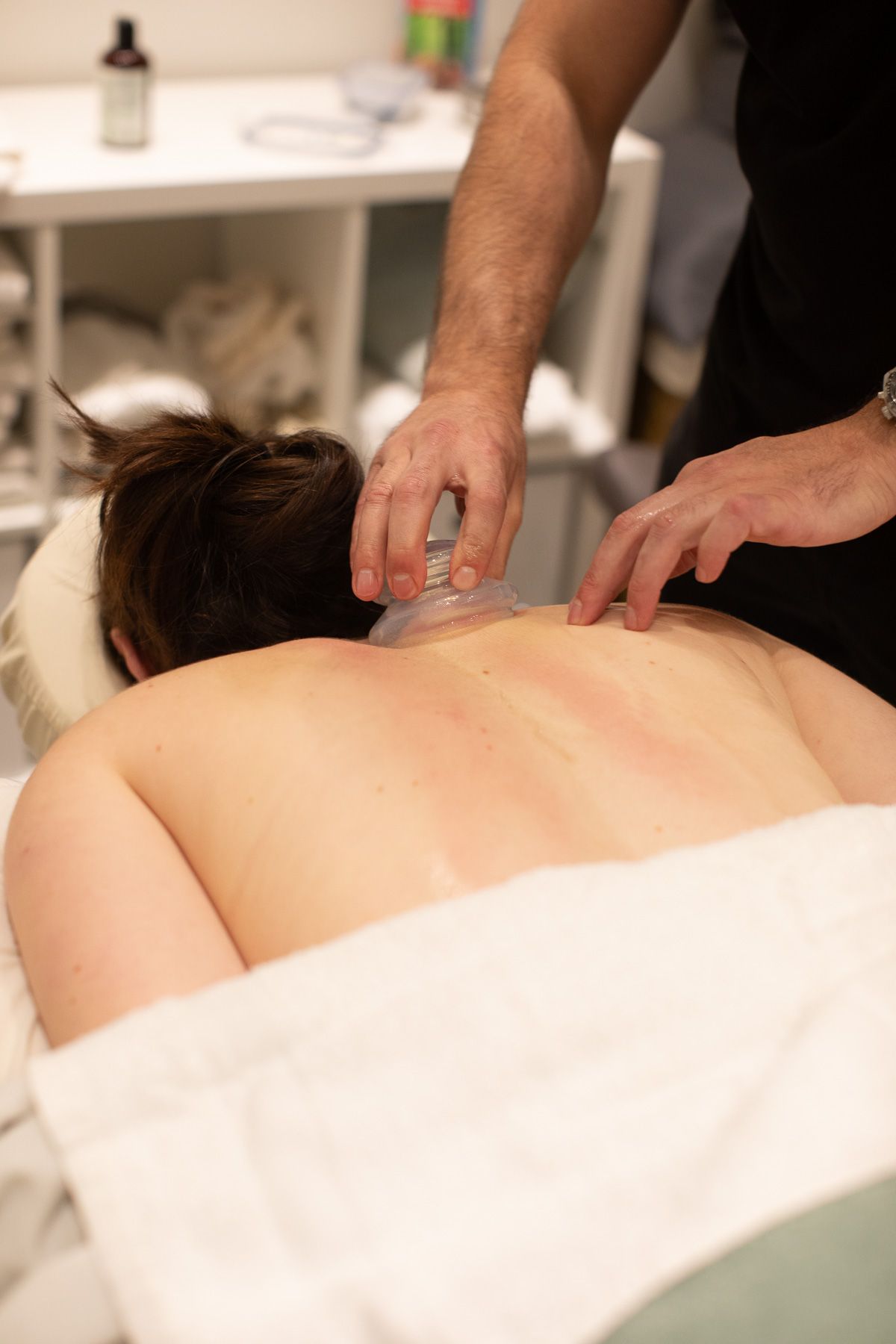 Cupping