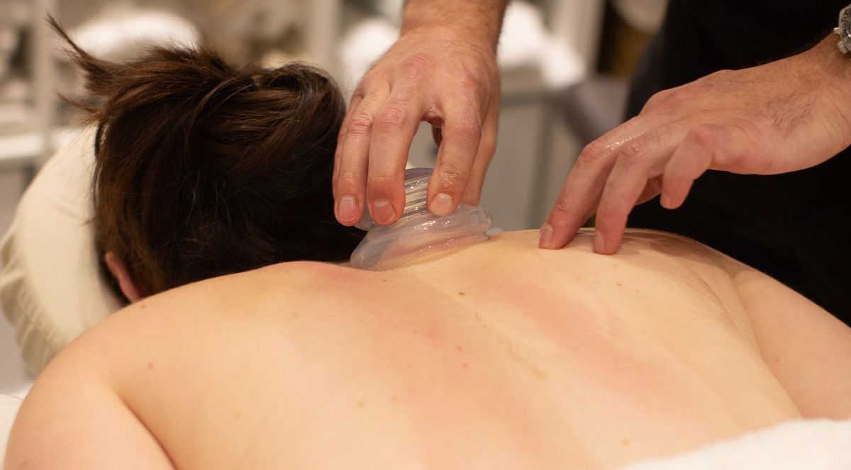 Cupping