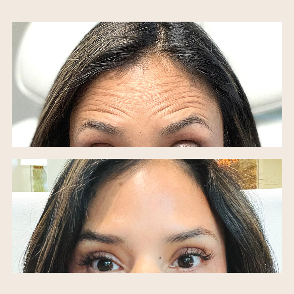 Skin Rejuvenation Medical Spa Services In Murrieta DermaVogue West