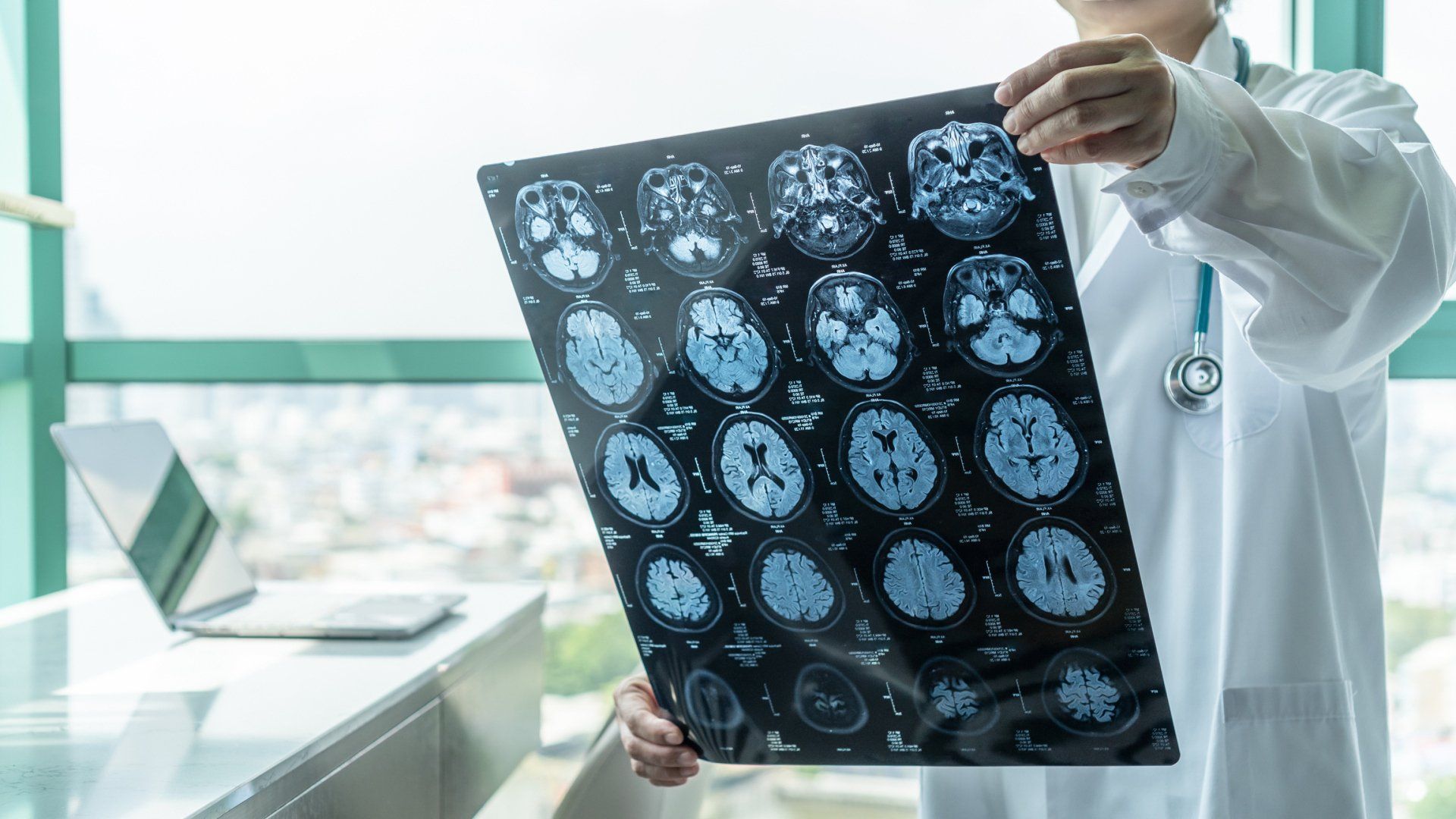A Doctor Holding Scan Result — Powell, Ohio — Dublin Family PT