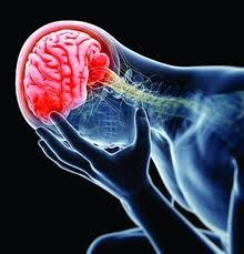 An x-ray of a person with a concussion
