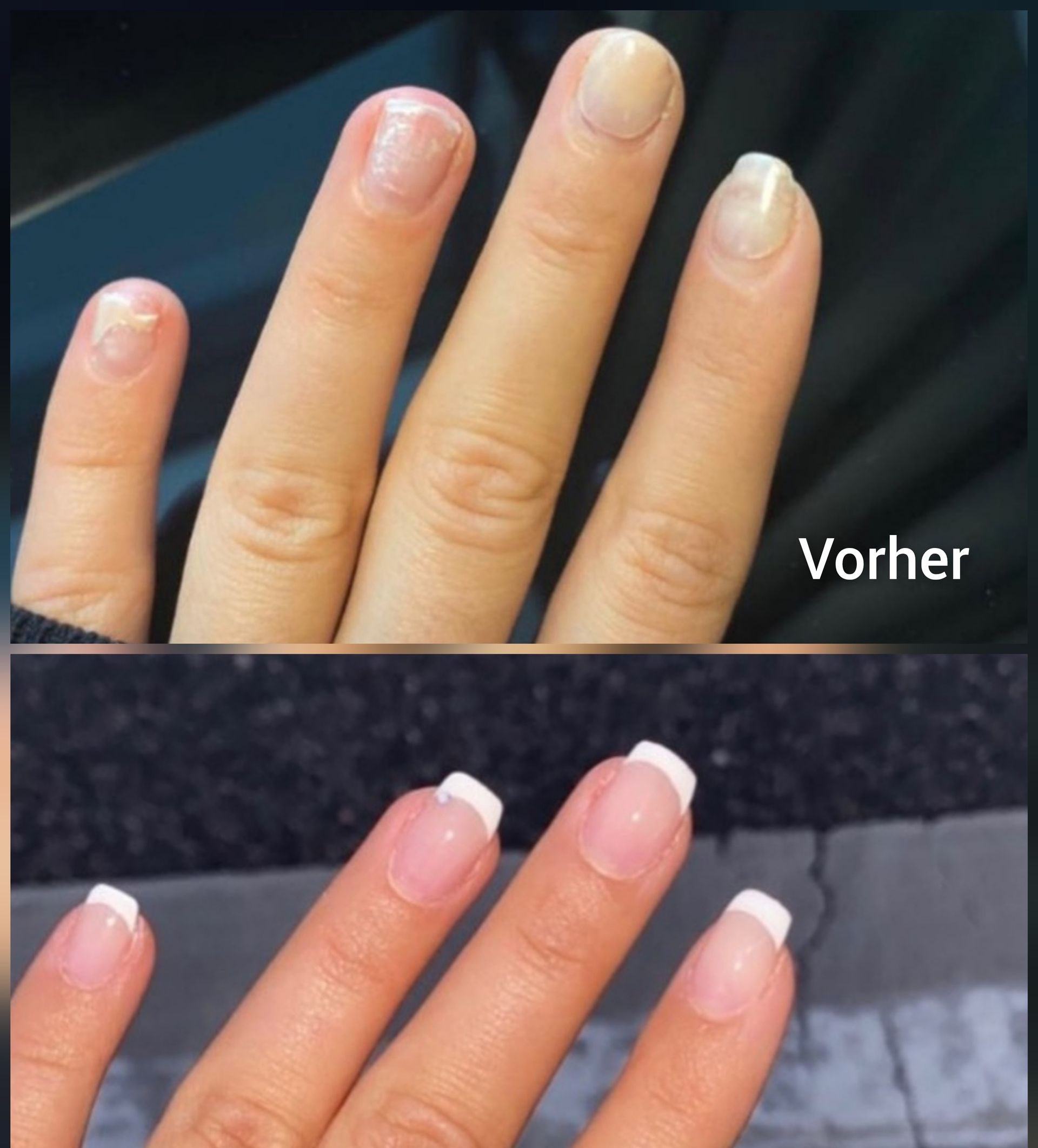 Nahaufnahme vor und nach der Maniküre von Nägeln mit rosa Nagellack und weißen French Tips.