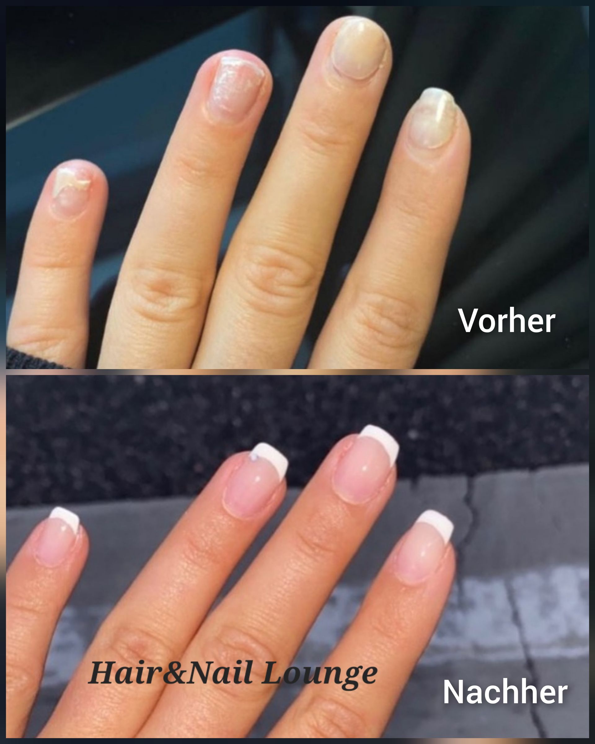 Vorher-nachher-Nahaufnahme der Fingernägel; links kürzere Naturnägel, rechts längere, rosa lackierte Nägel.