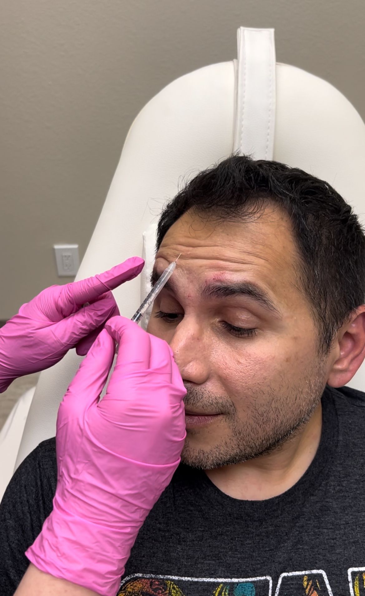 Jeuveau neurotoxin injection for forehead lines at Skin & Soul Med Spa
