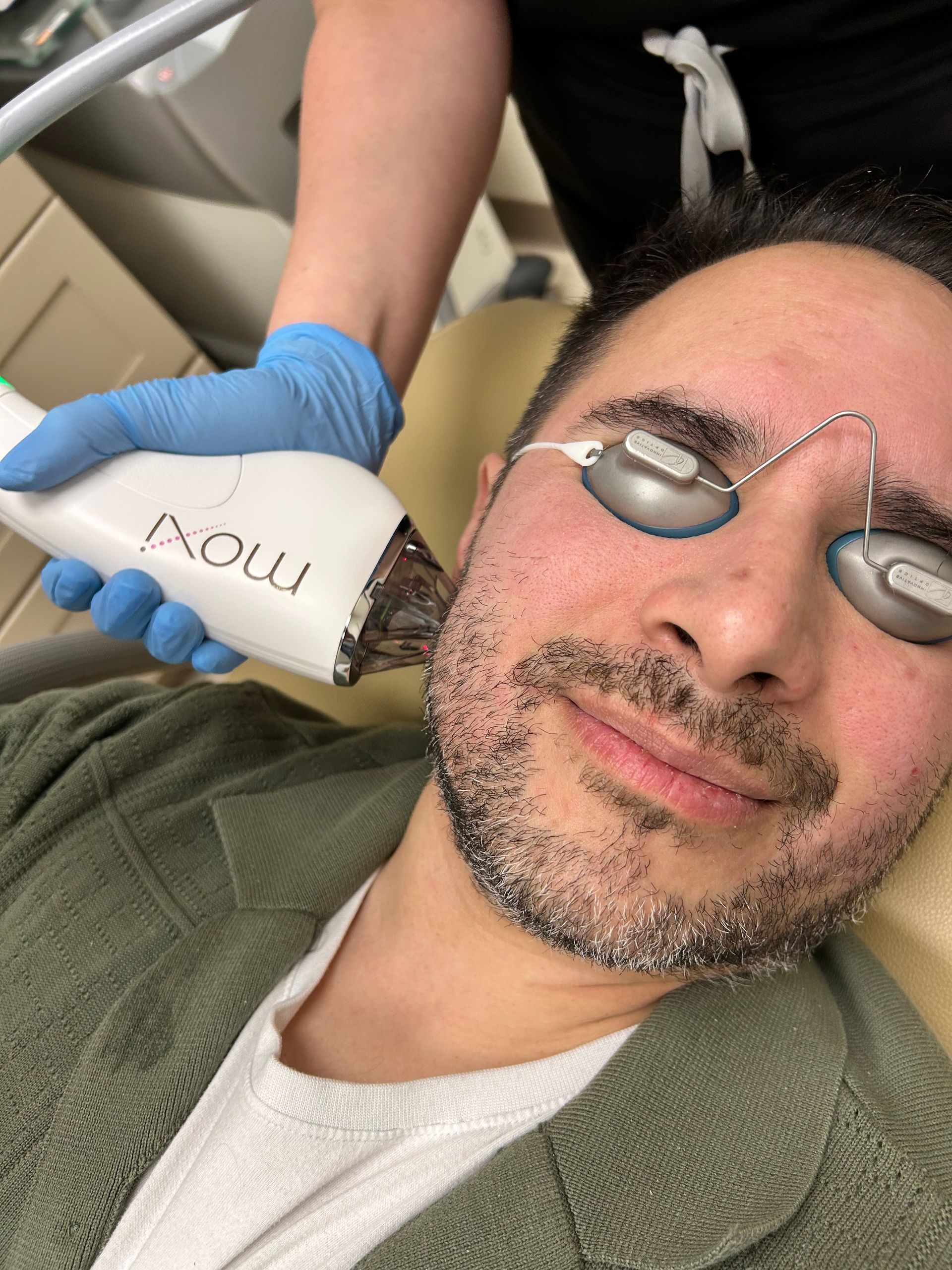 MOXI laser treatment being performed at Skin & Soul Med Spa in Seabrook TX
