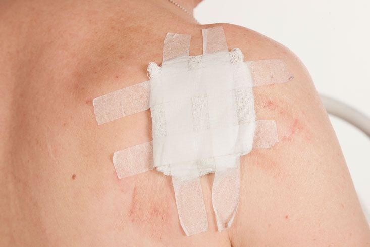 CLINICA DE LESIONES DERMICAS PROMEDICA  -  HERIDAS