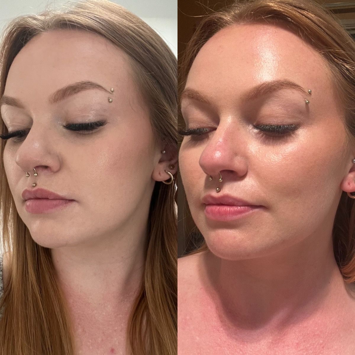 Skin Consultation in Forster | Vanity Skin and Beauty