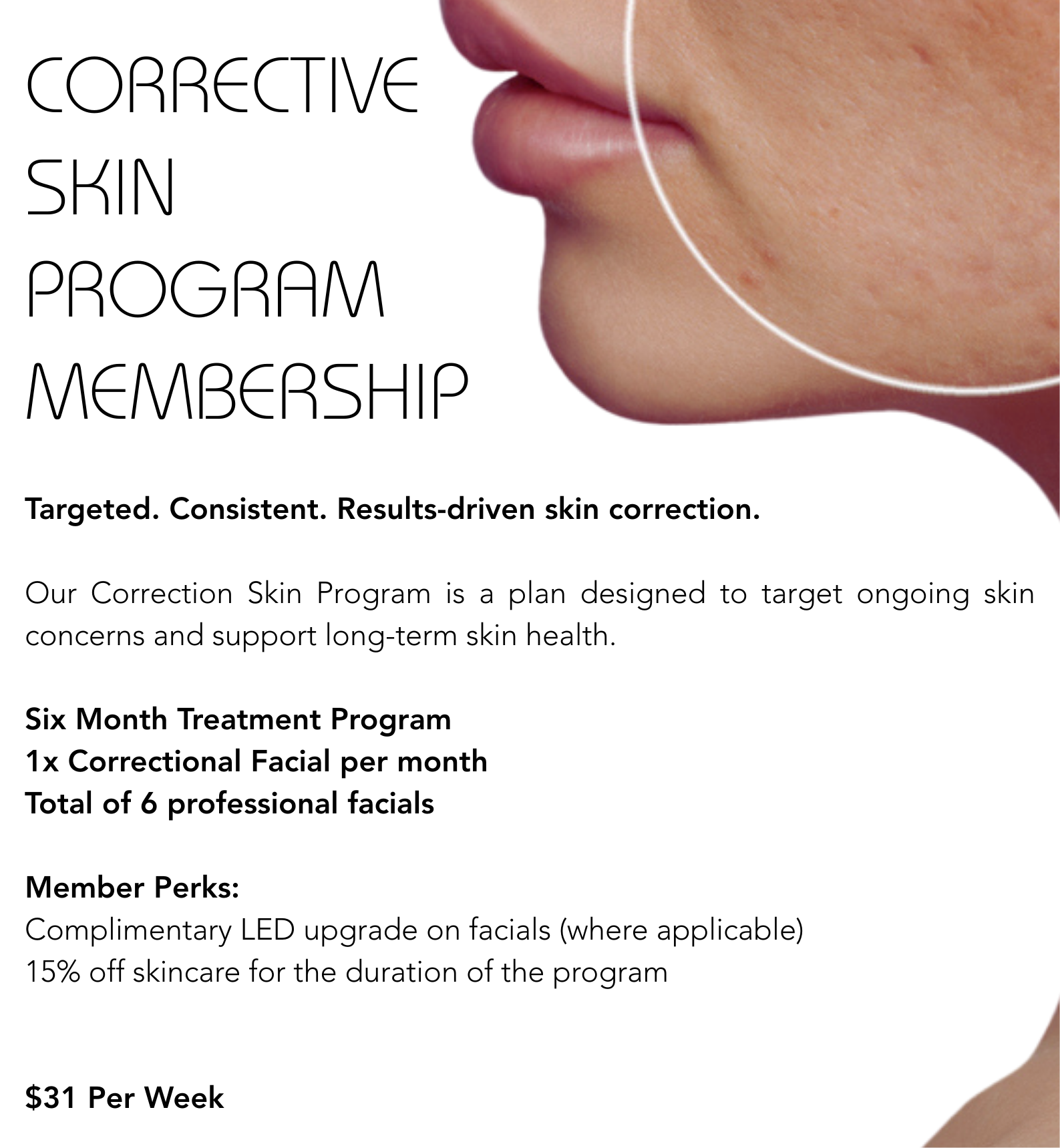 Corrective skin program membership — Vanity Skin and Beauty Forster in Forster, NSW