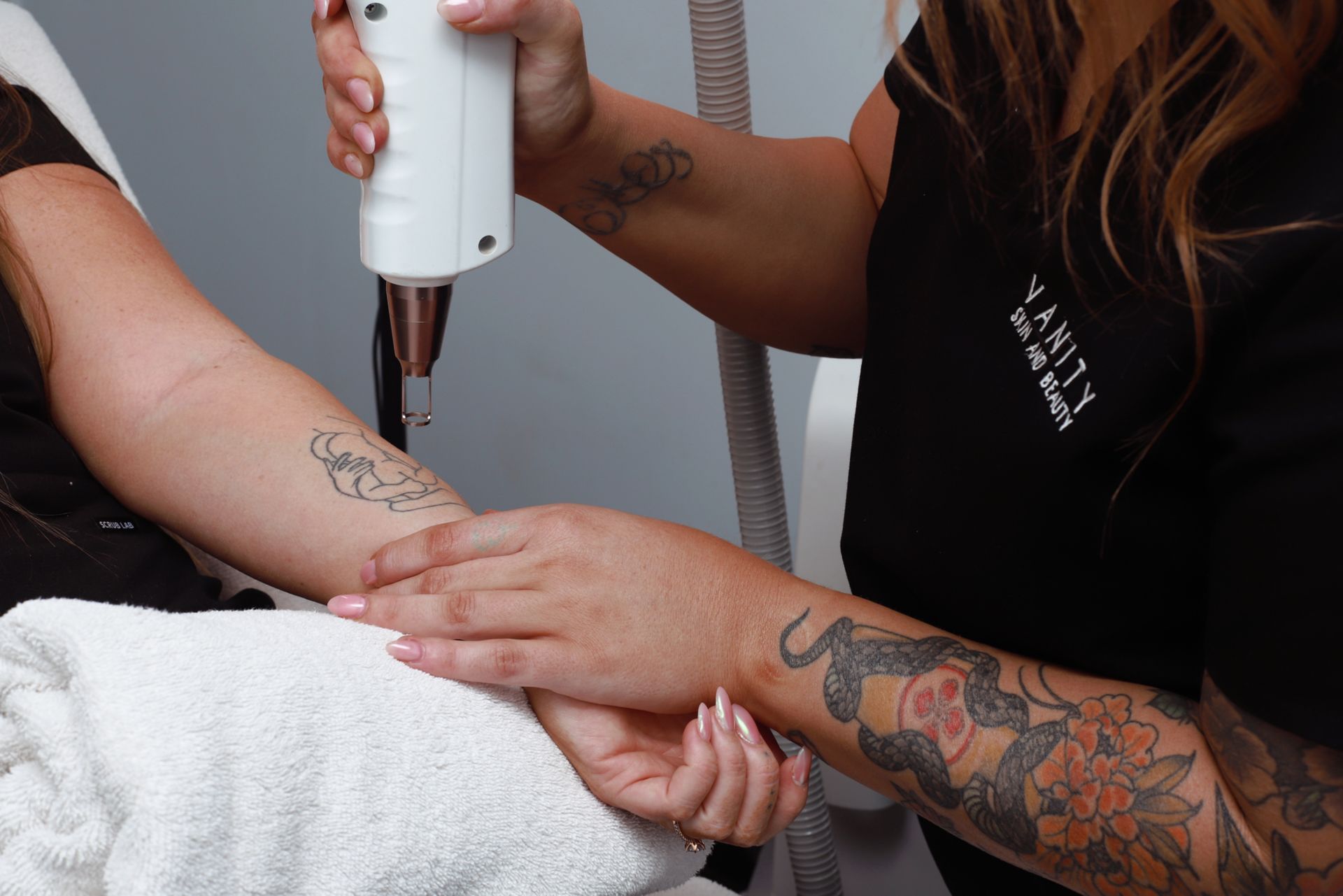 A Before And After Photo Of A Tattoo On A Woman's Face And Neck — Vanity Skin and Beauty Forster in Forster, NSW