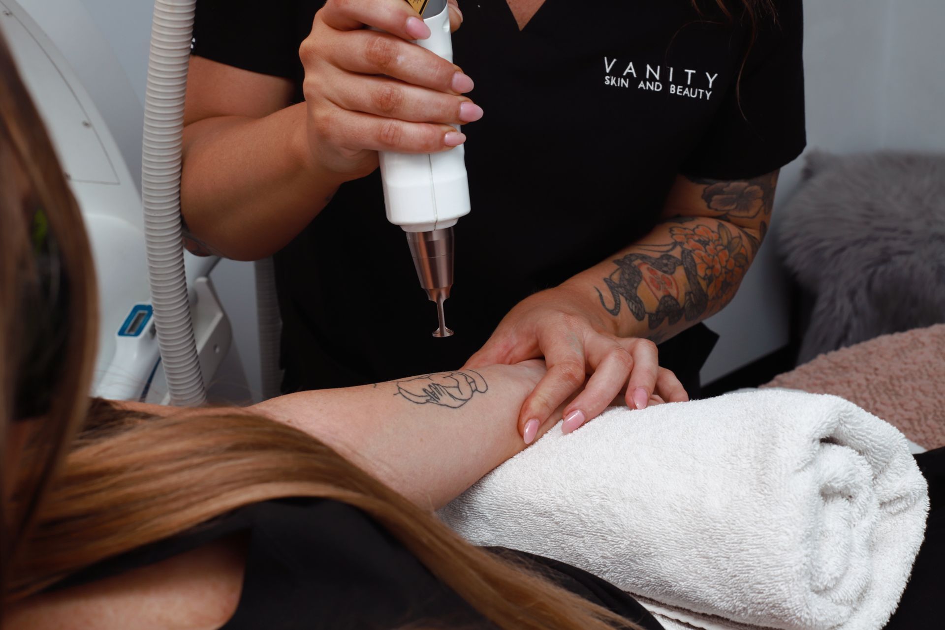 A woman is getting a tattoo removed from her arm. — Vanity Skin and Beauty Forster in Taree, NSW