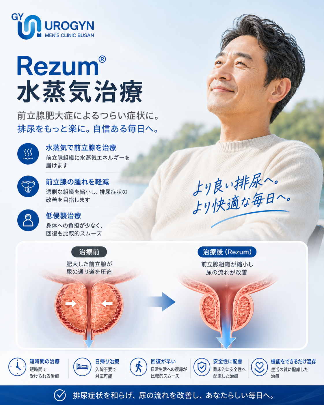 ユロジン男性クリニック 釜山西面のRezum水蒸気BPH治療
