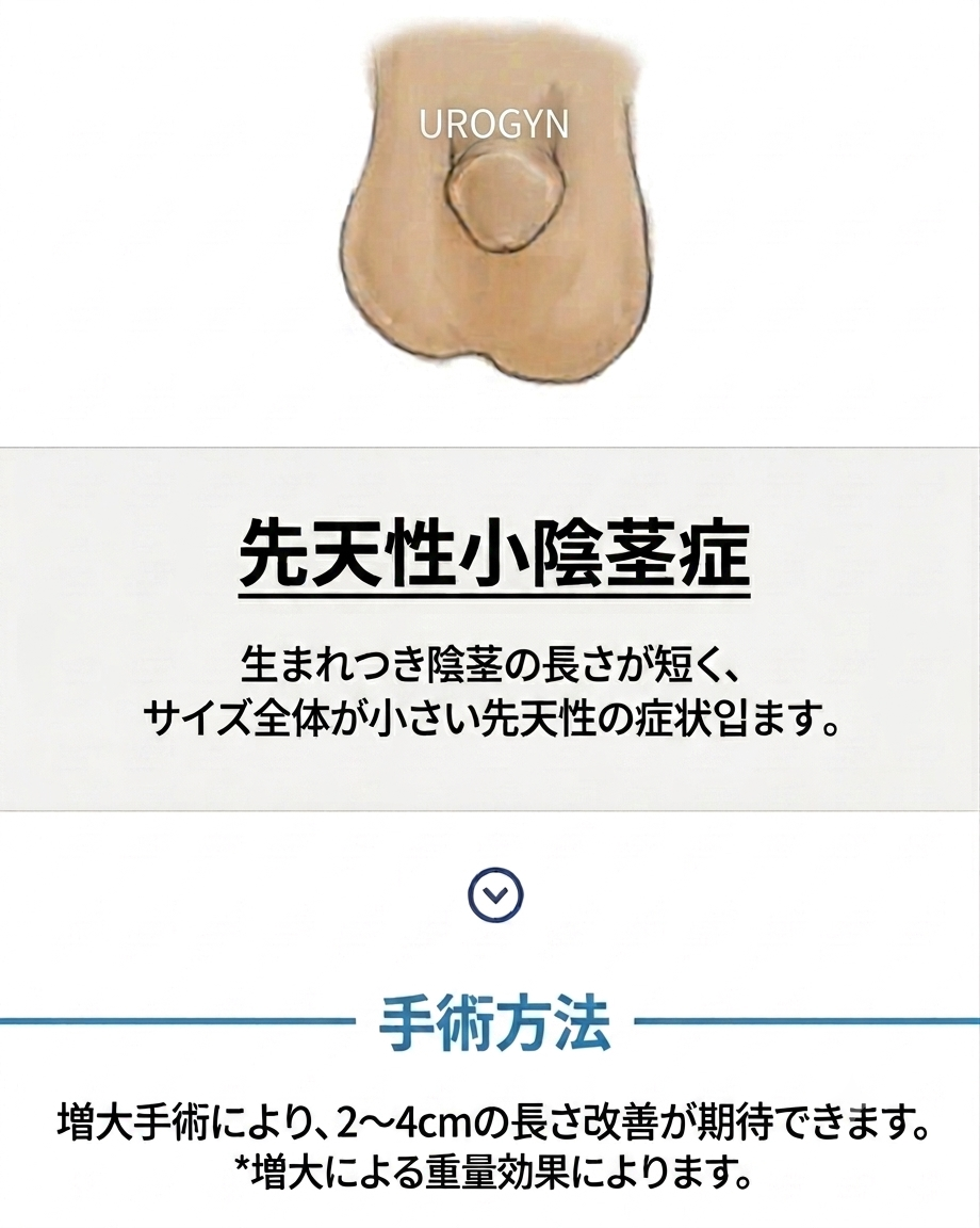 ユロジン男性クリニック 釜山西面の成人先天性小陰茎ケアの処置