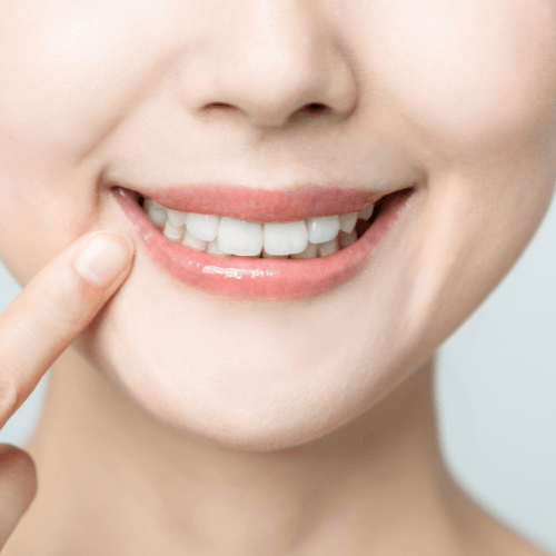 Close up smiling woman | Fix cavities with durable dental fillings in Overland Park 66221.