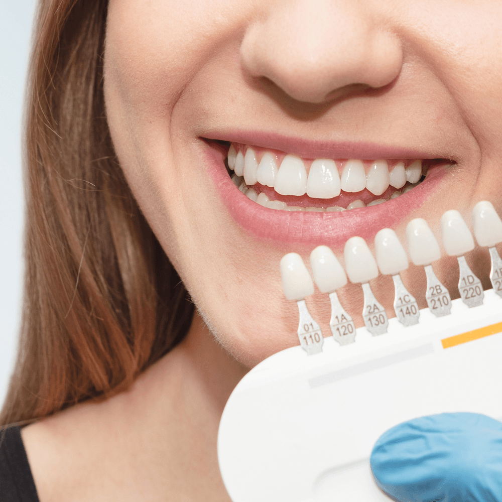 Teeth color matching | Brighten your smile with teeth whitening in Overland Park 66221.
