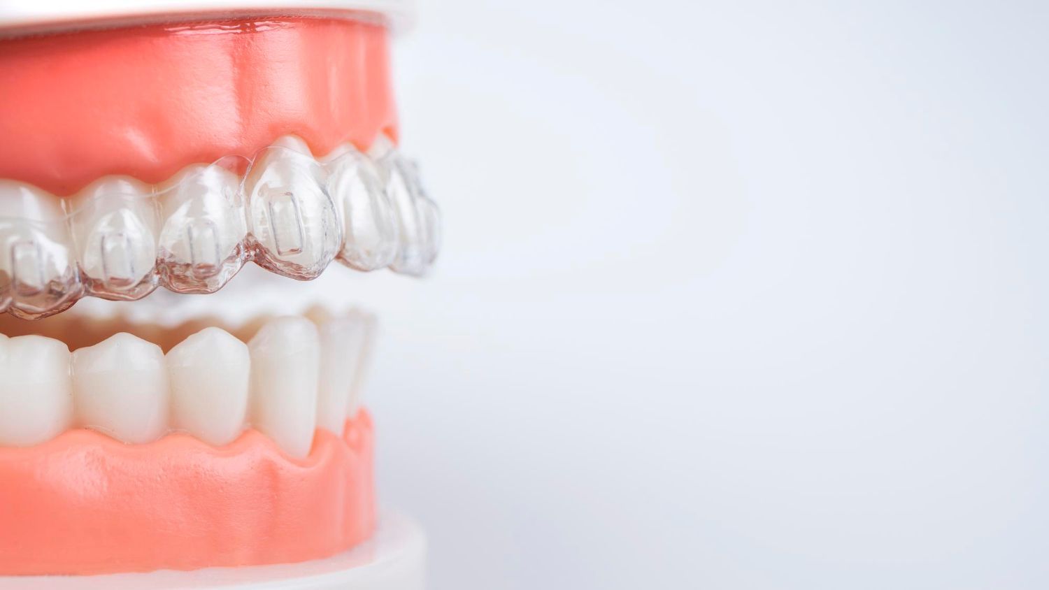 invisalign