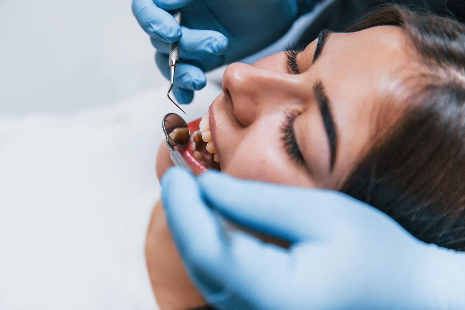 smile makeover