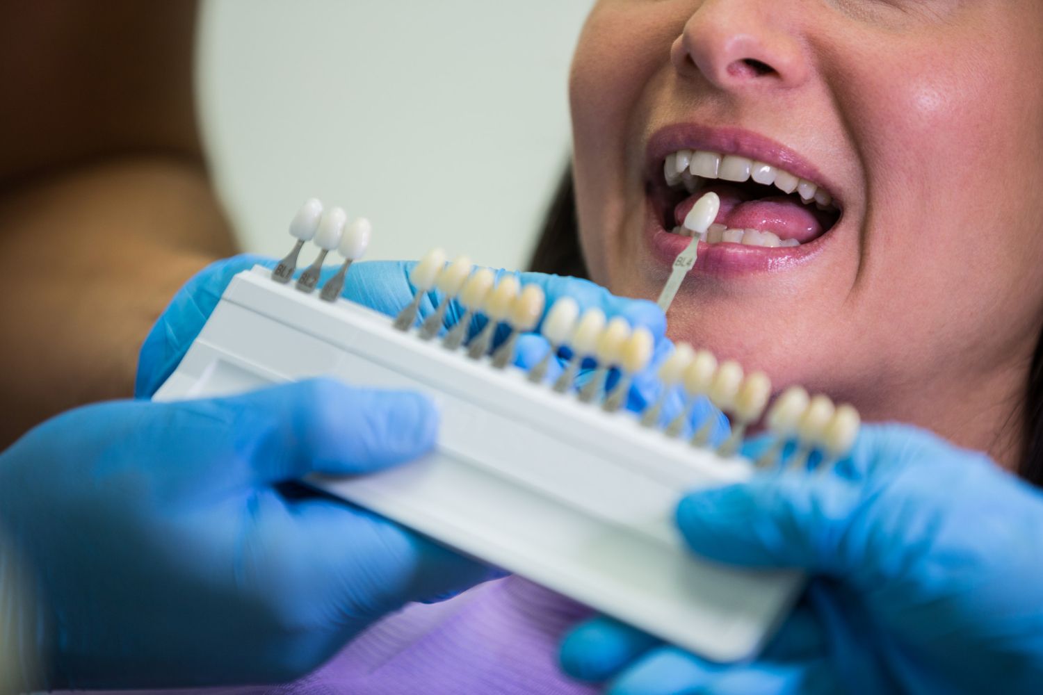 Dental Crown