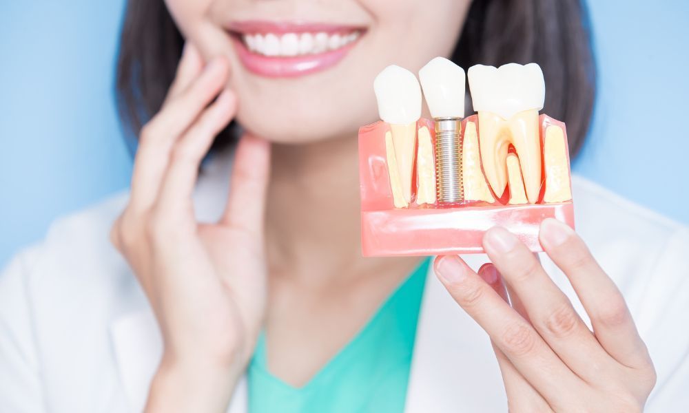 Dental Implants