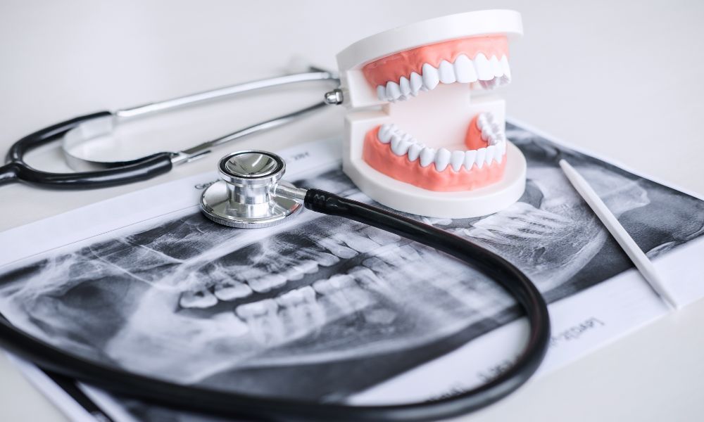 Oral Appliance Therapy over CPAP