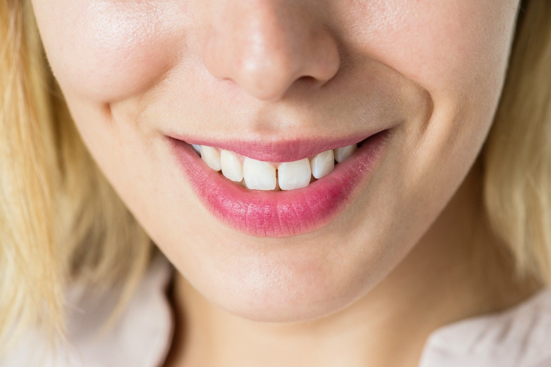 teeth whitening
