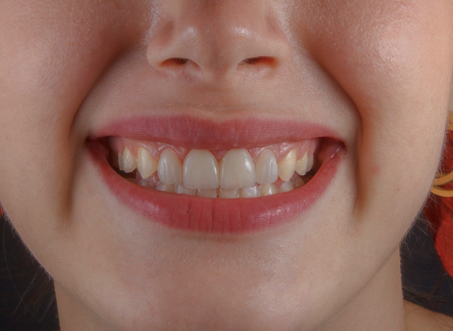Teeth