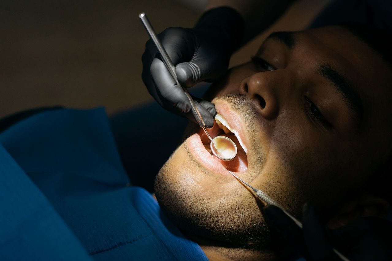 Dental Implants
