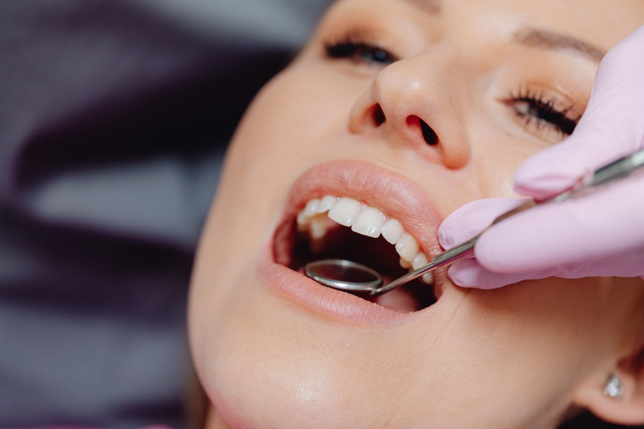 Teeth Whitening
