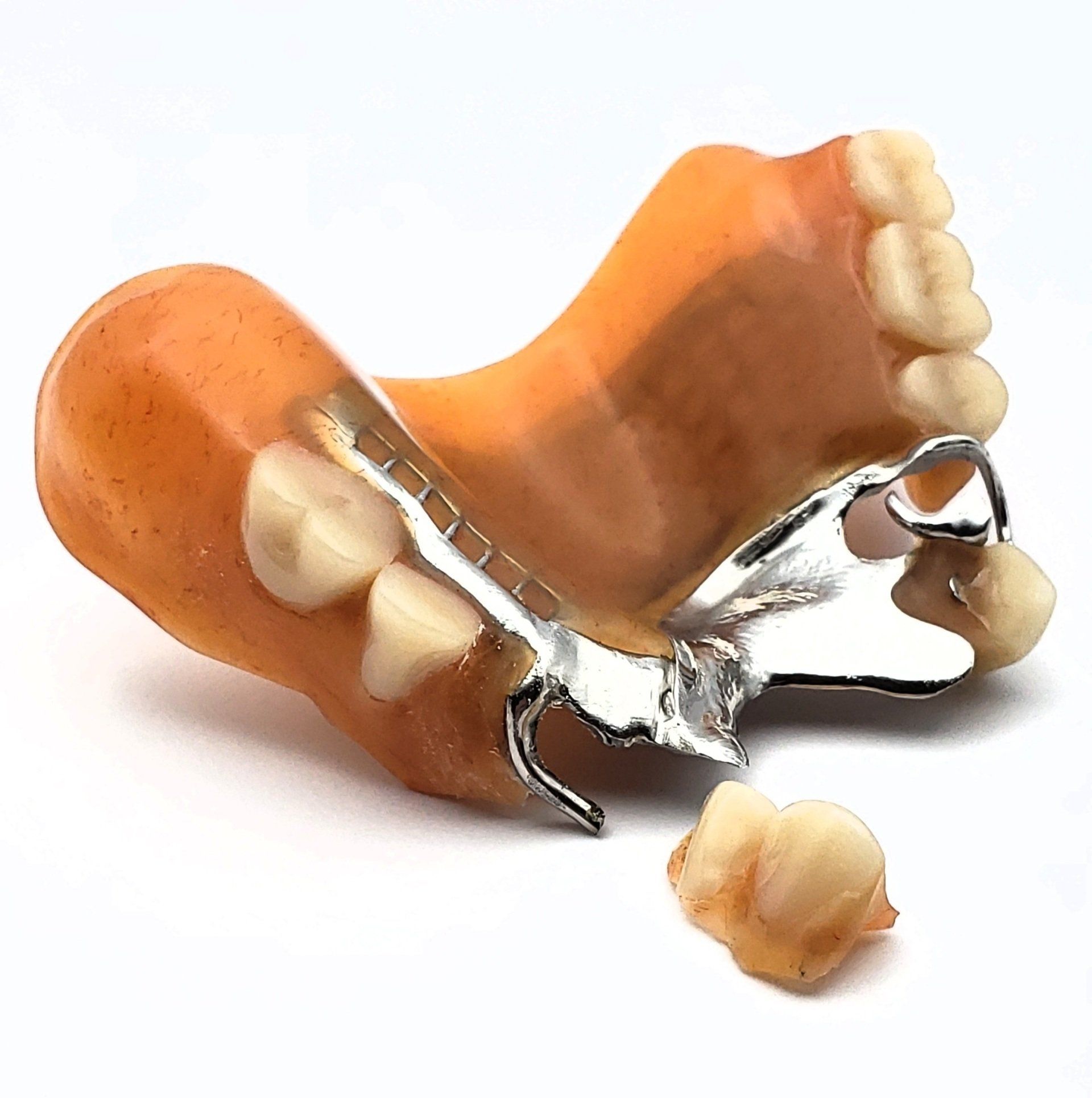 damaged upper partial metal denture