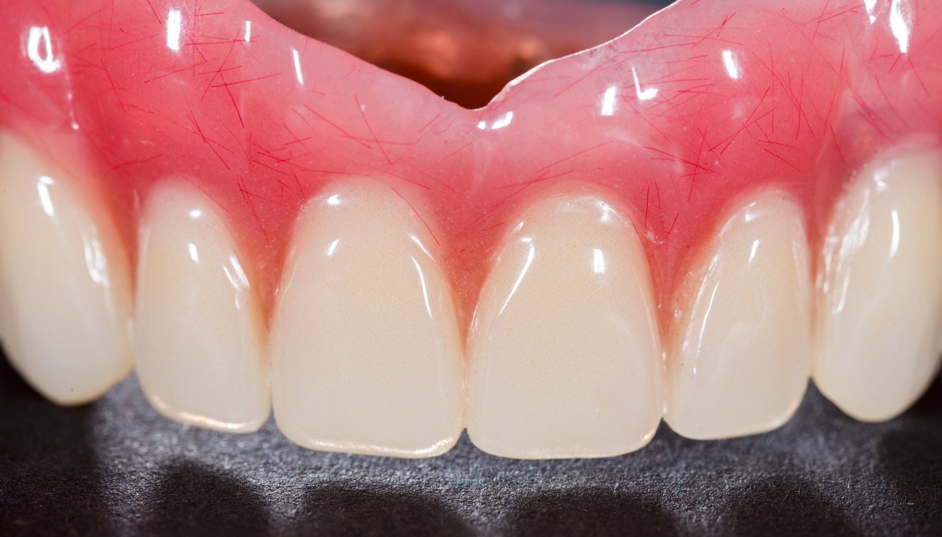 anatomized custom denture