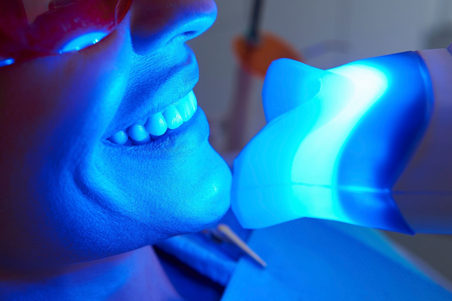Person's smile lit by bright blue dental whitening light in a dentist's office.