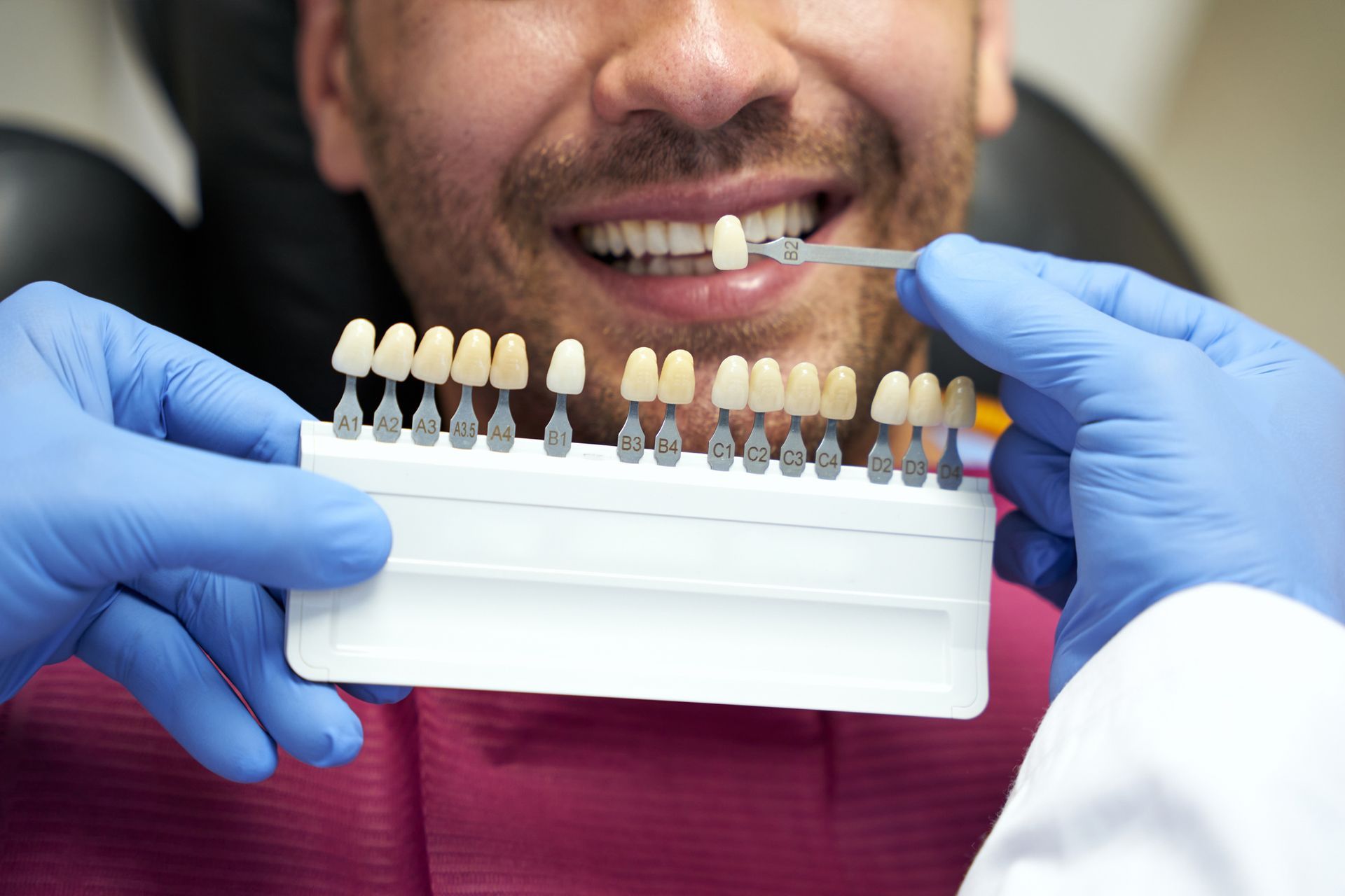 Dentist comparing tooth shade with a guide, patient smiling in dental chair.