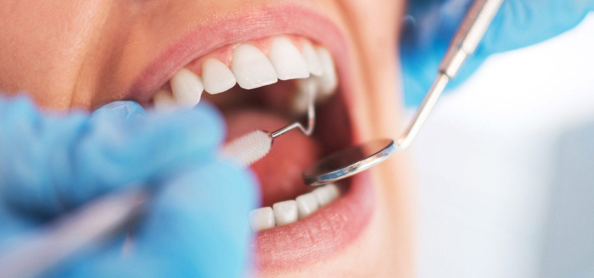 Oral Checkup — Rochester Hills, MI — The Elite Smile Center