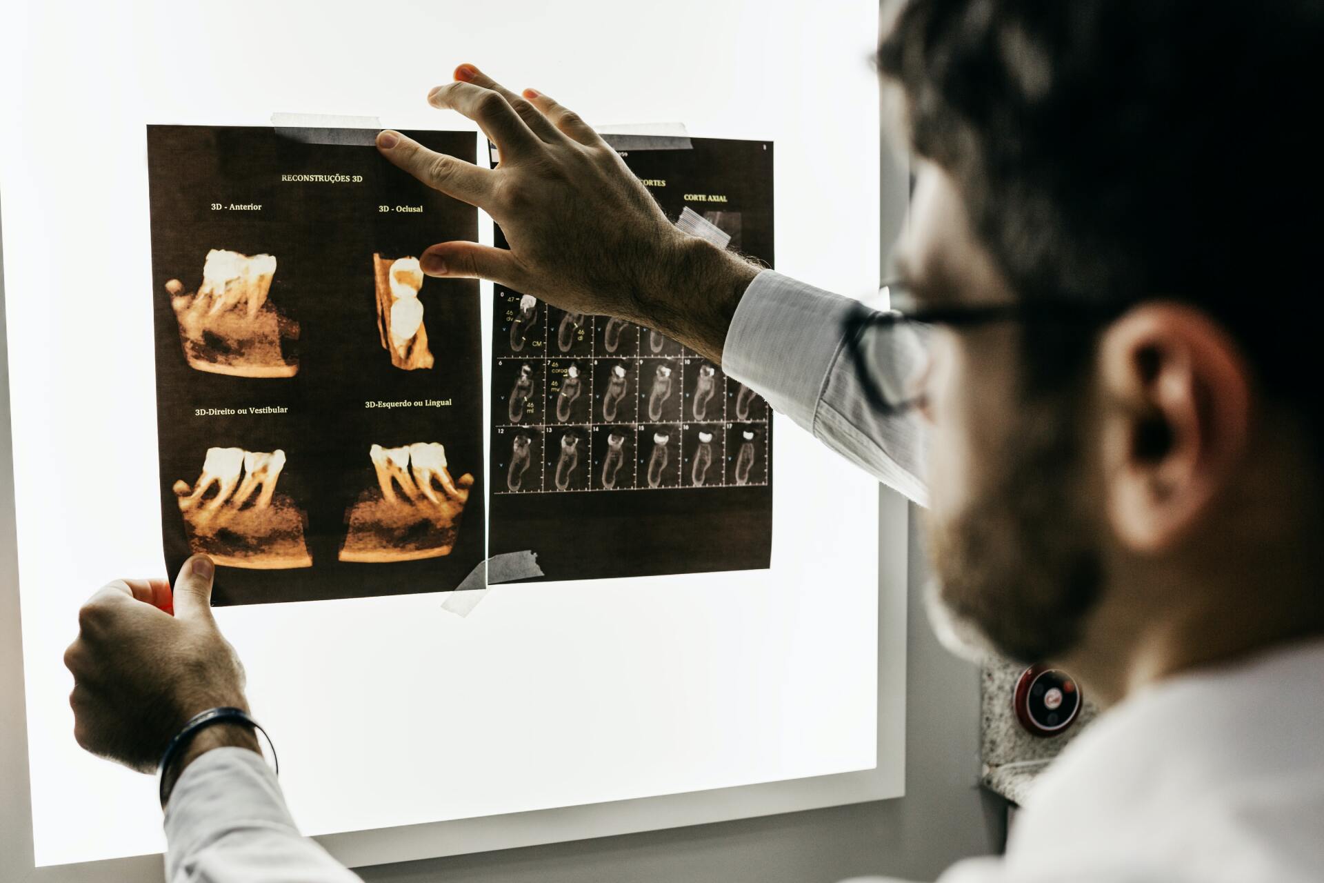 Dentist examines dental X-rays on a light panel.
