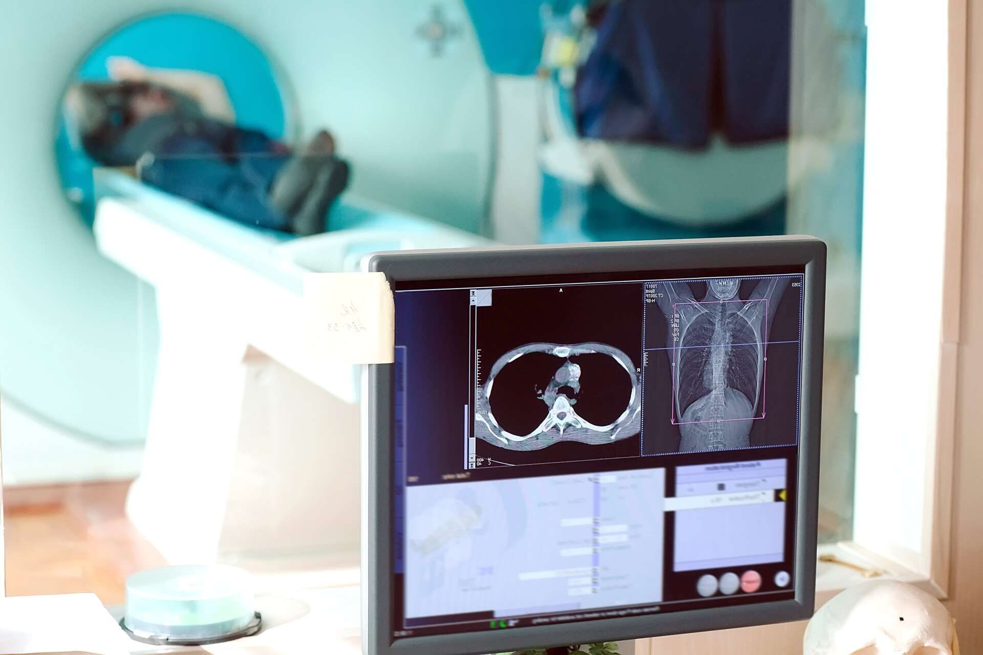 Whole Body MRI Scan