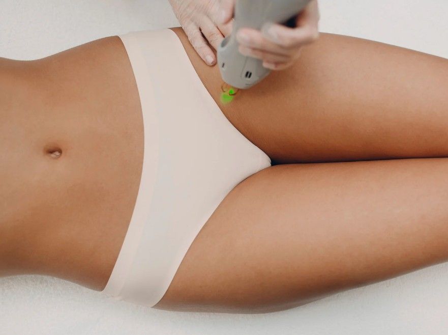 Laser Hair Removal Coventry providing brazilian laser hair removal in Coventry
