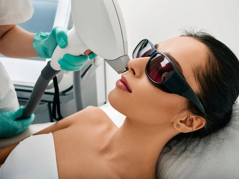 using the laser to remove peach fuzz fine facial hair from a womens upper lip