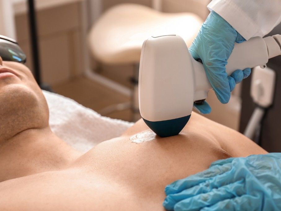 Laser Hair Removal Coventry providing laser hair removal for a man's chest in Coventry Clinic