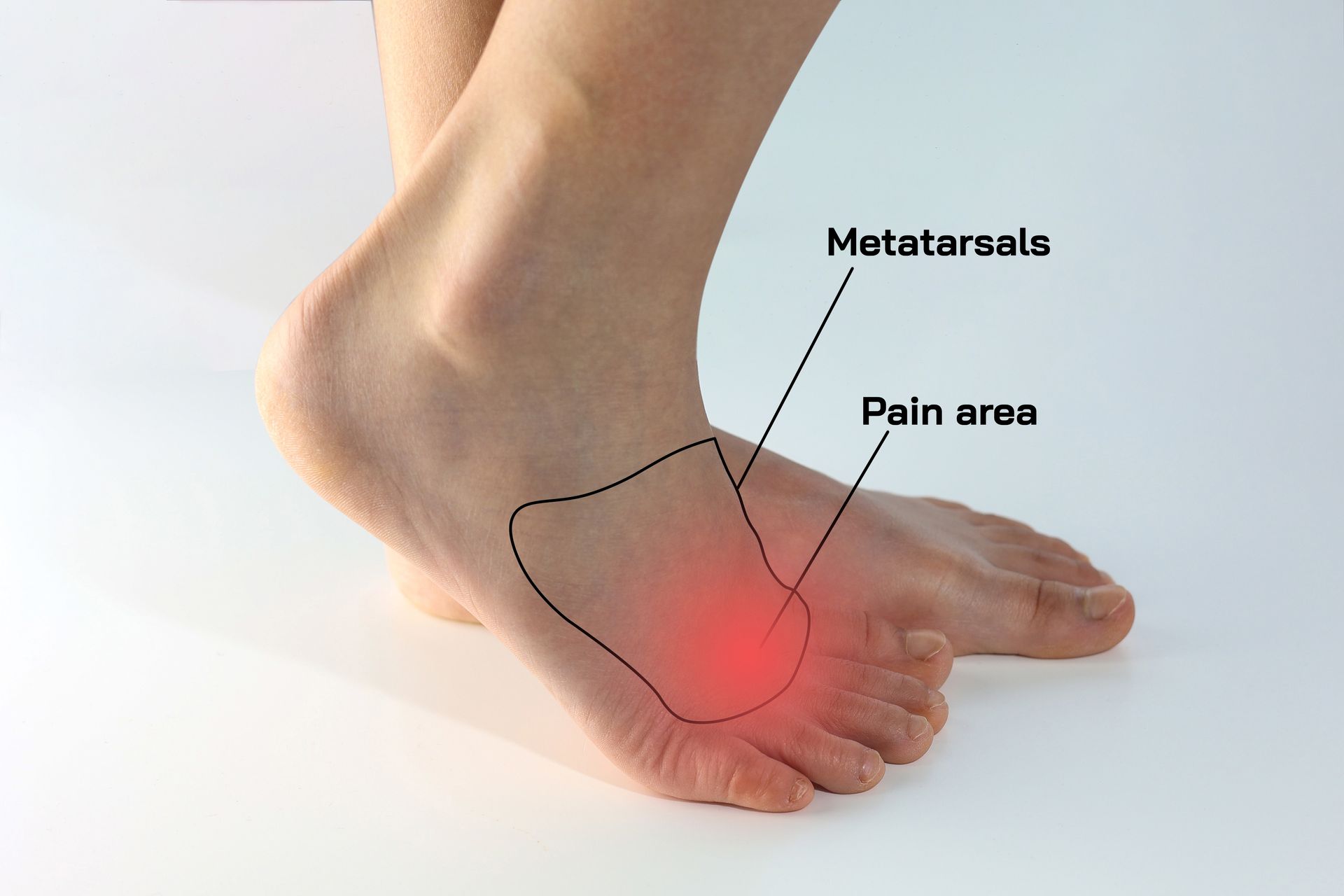 A close up of a person 's foot with a diagram showing the pain area.