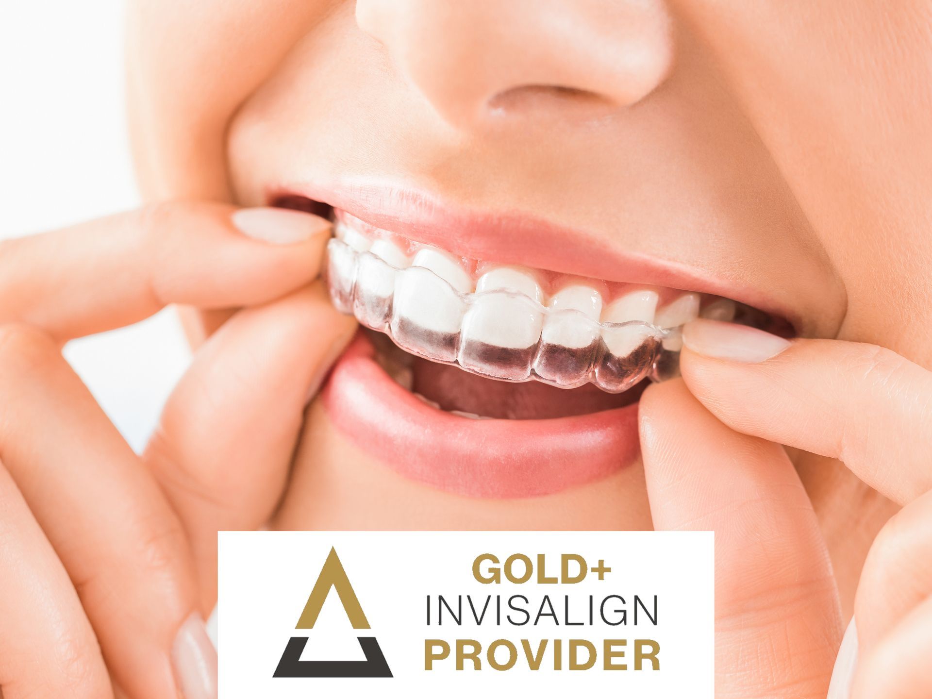 Close-up of teeth with clear aligner being adjusted, plus Gold Invisalign Provider logo