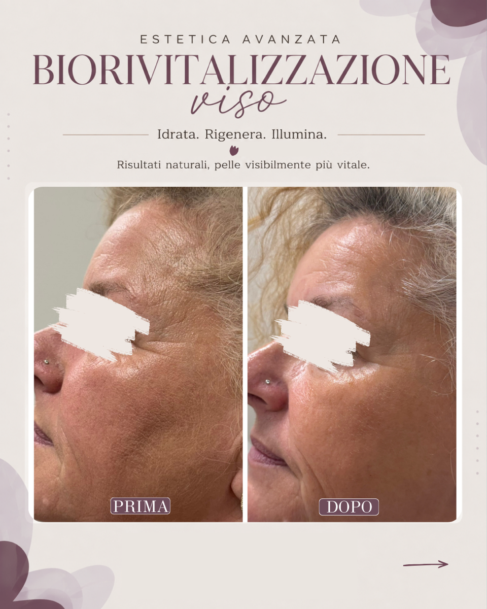 Video promozionale di un prodotto per la cura della pelle che mostra il profilo di un viso con i risultati 