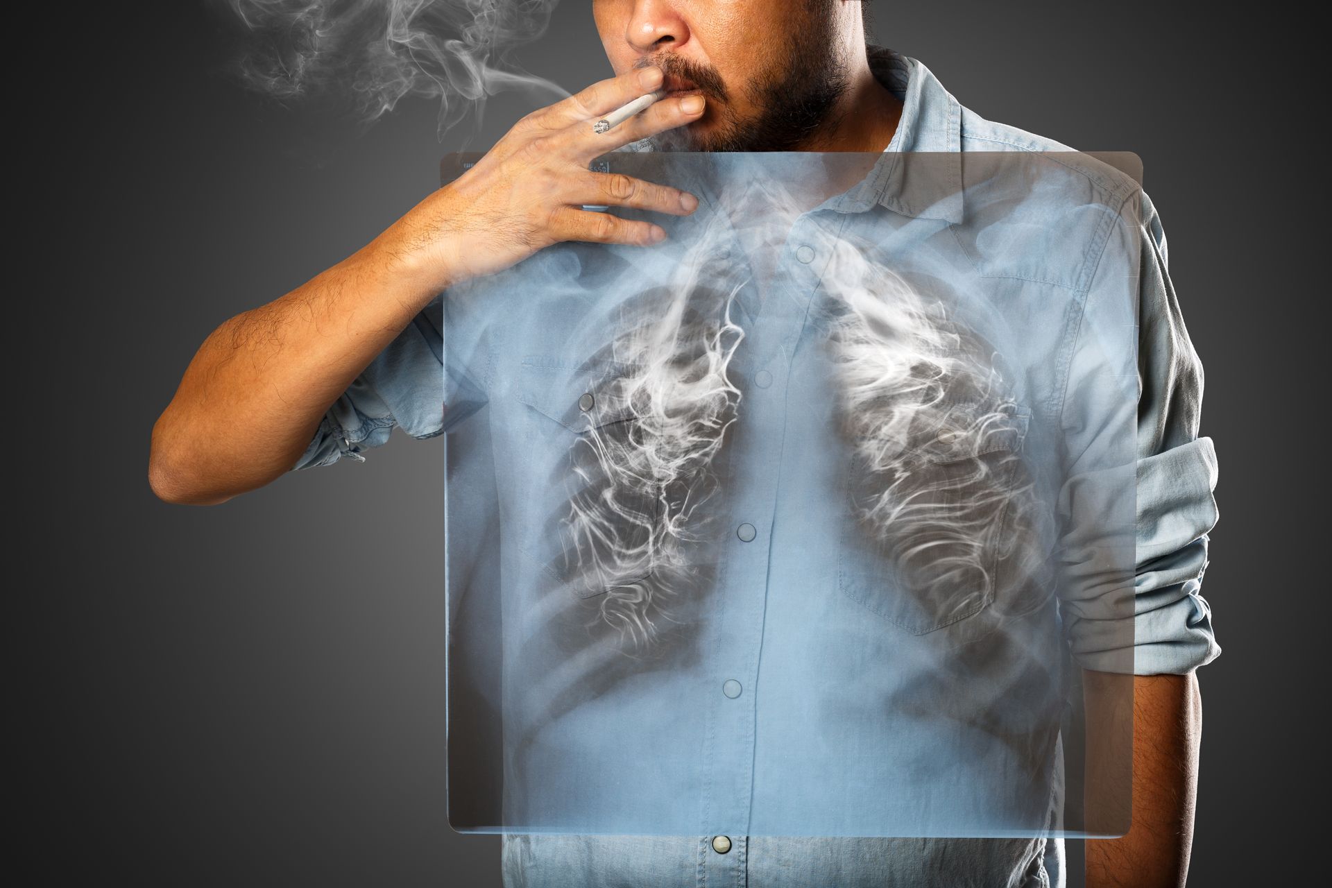 Um médico está segurando uma radiografia dos pulmões de um paciente.