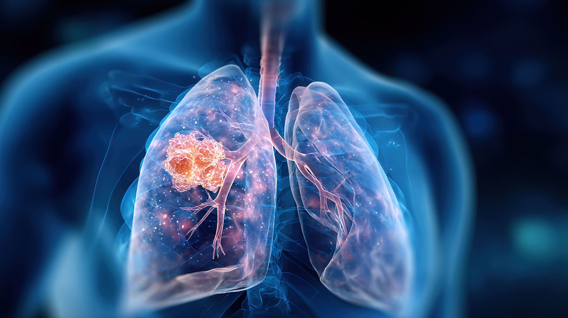 doenças raras respiratórias