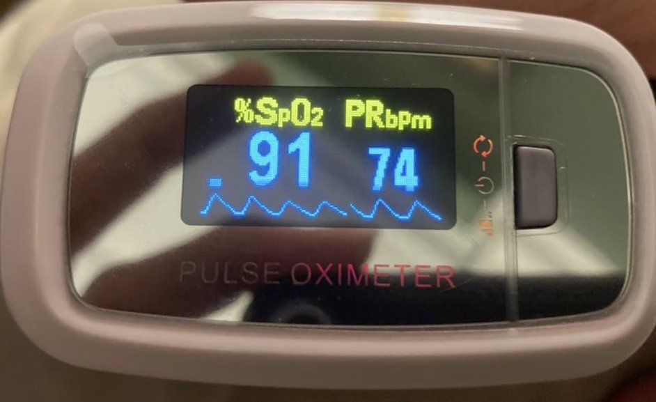 abaixo das medidas, nota-se a onda do pulso arterial