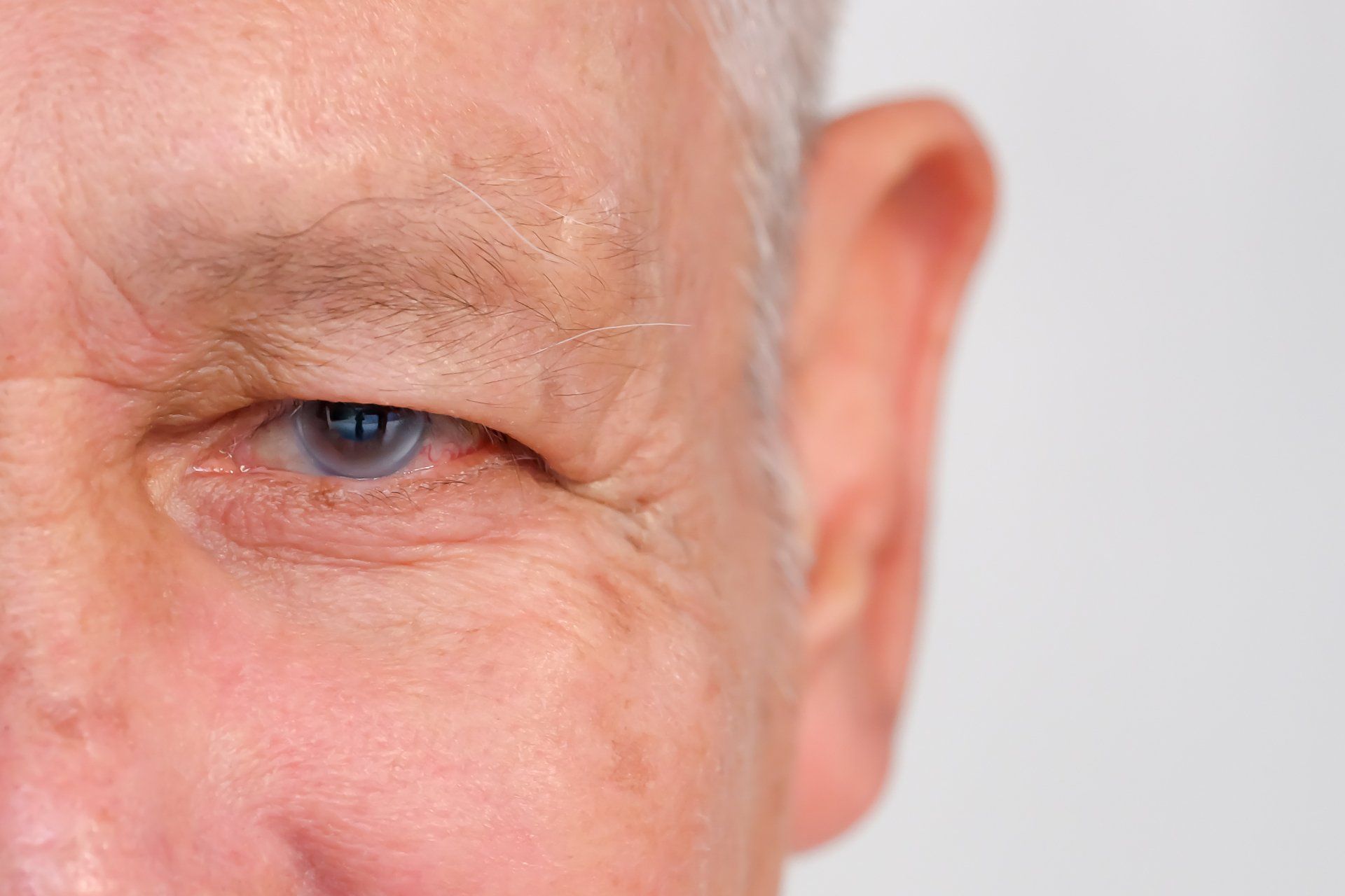 Minimally Invasive Glaucoma Surgery
