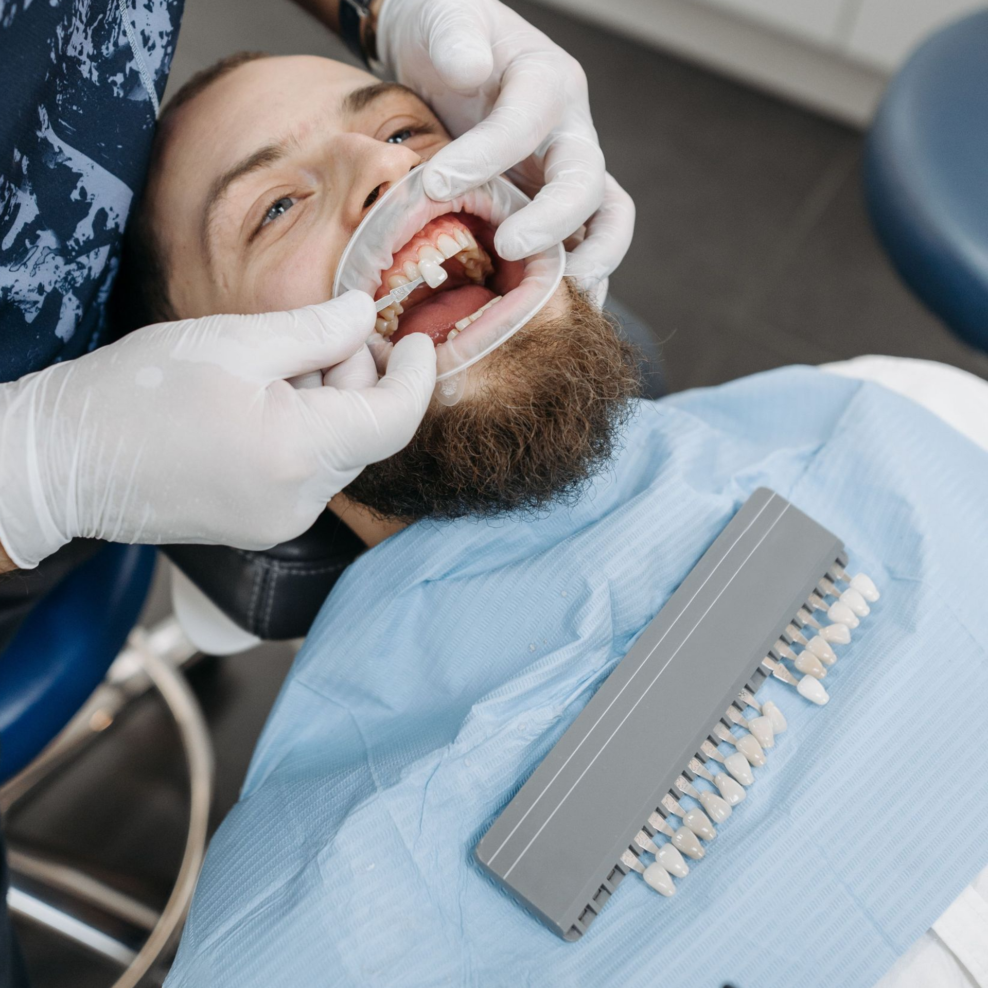 Dental Crown Procedure