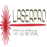 Laserpro Tattoo Removal